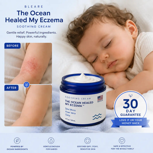 Sea Moss Eczema Soothing Cream
